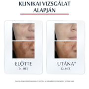 EUCERIN Anti-Pigment Dual szérum (30ml) termék 2. képe