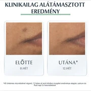 EUCERIN DermoPure hármashatású szérum (40ml) termék 2. képe