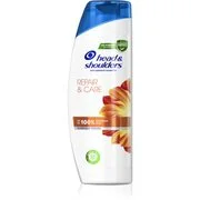 Head & Shoulders Repair & Care korpásodás elleni sampon 400 ml akciós termékkép 1