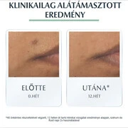 EUCERIN DermoPure Protektív fluid SPF30 (50ml) termék 2. képe