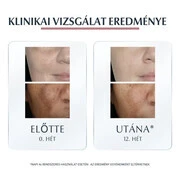 EUCERIN Anti-Pigment korrektor stift (5ml) termék 2. képe